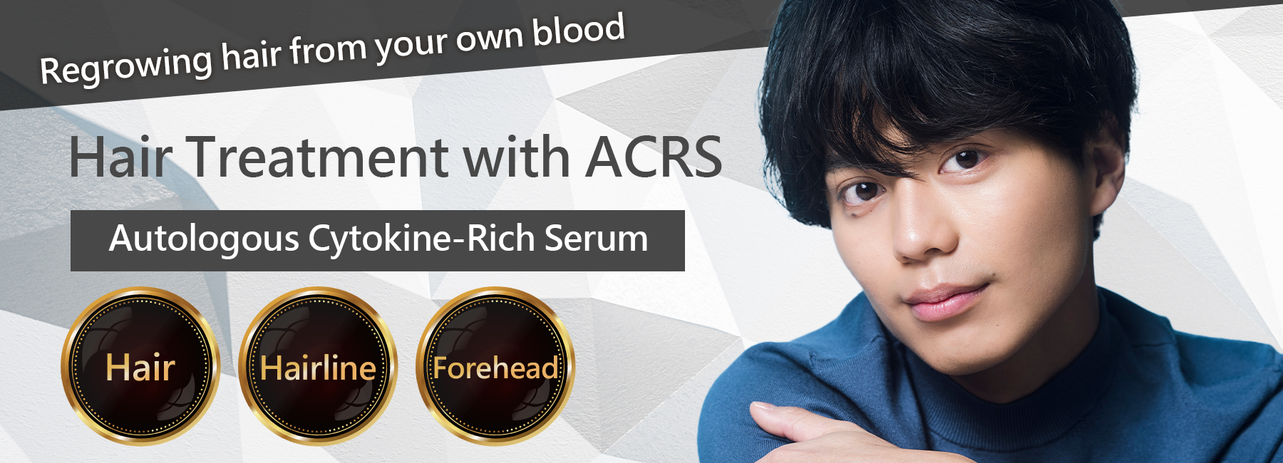 Regrowing hair from your own blood. Hair Treatment with ACRS
Autologous Cytokine-Rich Serum. Hair,Hairline,Forehead.