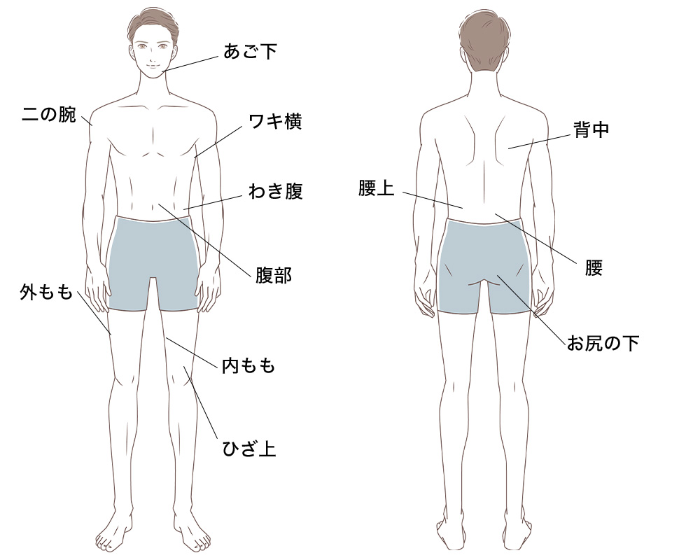 クール・スカルプティング適用部位