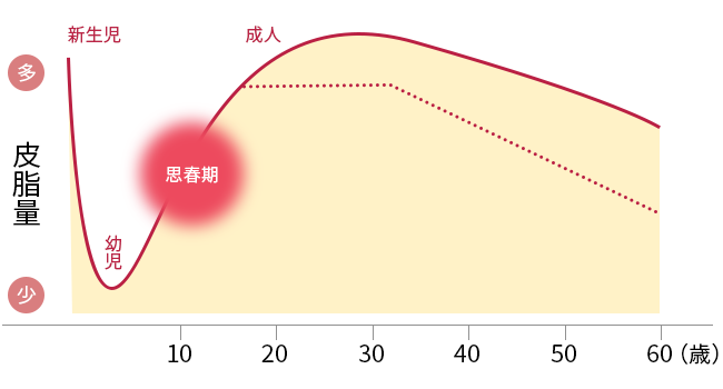 ニキビは思春期から成人後も続く